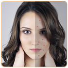 Acne remover иконка