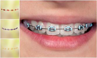 Real Teeth Braces Photo Maker скриншот 3