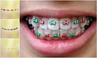 Real Teeth Braces Photo Maker Affiche