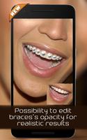 پوستر Braces on teeth Photo editor