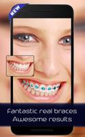 برنامه‌نما Braces on teeth Photo editor عکس از صفحه