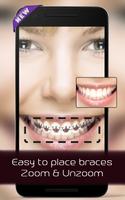 برنامه‌نما Braces on teeth Photo editor عکس از صفحه