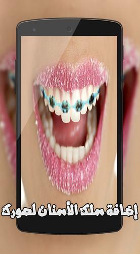 تركيب تقويم الاسنان على الصور for android apk download