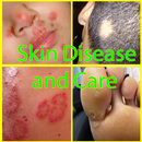 APK Skin Disease and Care