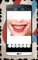 Braces For Teeth (Real Look) Ekran Görüntüsü 1