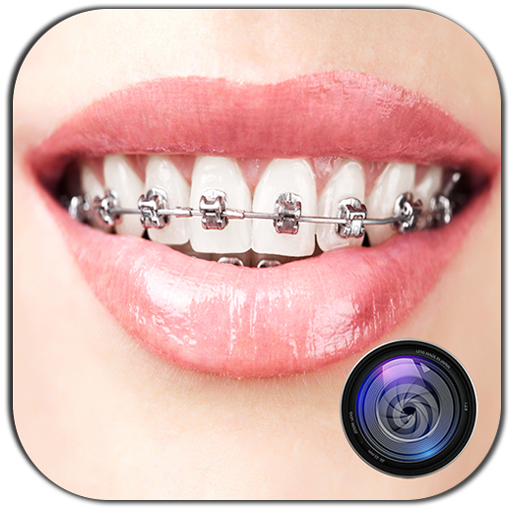 Braces Photo Editor Beauty