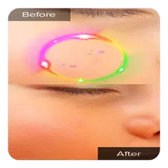 Face Blemishes Cleaner & Face Pimple Removal APK download