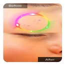 Face Blemishes Cleaner & Face Pimple Removal APK