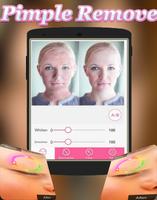 Face Blemishes Cleaner & Face Pimple Removal capture d'écran 1