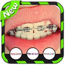 Braces PhotoBooth (Brackets) APK