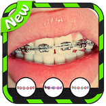 Braces PhotoBooth (Brackets)