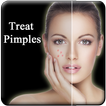 Pimple Remove in 7 Days