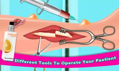 Leg Surgery Doctor Operation APK download