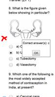 NEET Biology MCQs capture d'écran 2