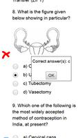 NEET Biology MCQs ภาพหน้าจอ 2