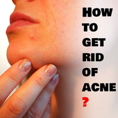 How to get rid of acne? biểu tượng