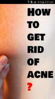 Poster How to get rid of acne?