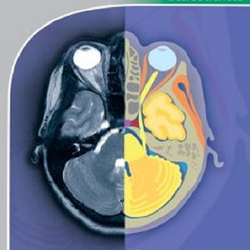 POCKET ATLAS OF CT HEAD