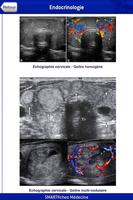 SMARTfiches Endocrino. Free capture d'écran 3