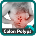 Pólipos de colon