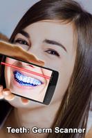 Teeth Germ Scanner Simulator Screenshot 1