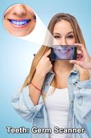 Teeth Germ Scanner Simulator Screenshot 2