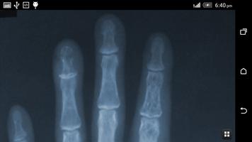 X-ray Scanner Prank screenshot 1