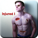 Injury Marks Photo editor 2017-2018 APK