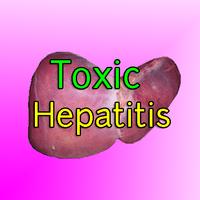 Toxic Hepatitis-poster