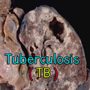 Tuberculosis TB APK