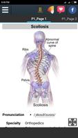 Scoliosis Info capture d'écran 3