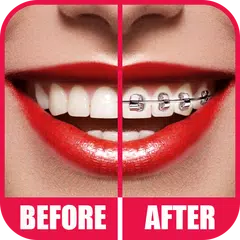 Baixar Aparelho dental 2.0 APK
