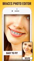 Braces پوسٹر