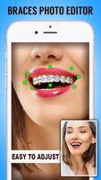 Braces اسکرین شاٹ 1