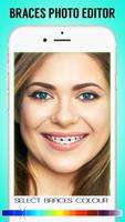 Braces اسکرین شاٹ 2