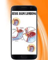 Mengatasi Asam Lambung पोस्टर