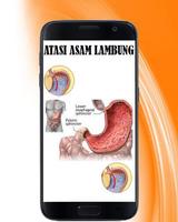 Mengatasi Asam Lambung capture d'écran 2