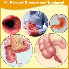 All stomach diseases and treat APK 下載