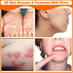 Descargar XAPK de All Skin Diseases and Treatmen