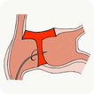 Transeptaid