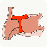 Icona Transeptaid