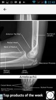 RADIOGRAPHY EXPOSURE FACTORS ảnh chụp màn hình 3