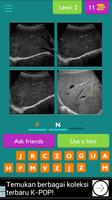 RADIOLOGY QUIZ FOR ULTRASOUND ảnh chụp màn hình 3