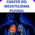 Cancer Mesotelioma Pleural