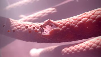 Hematology VR Poster