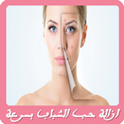 وصفات لازالة حب الشباب بسرعة biểu tượng
