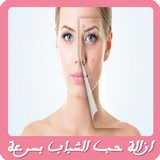 وصفات لازالة حب الشباب بسرعة biểu tượng
