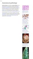 Pathology 截圖 2