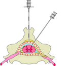 The spinal cord APK