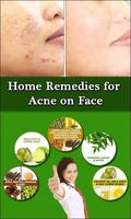 Remove Acne in 7 Days Guide تصوير الشاشة 3